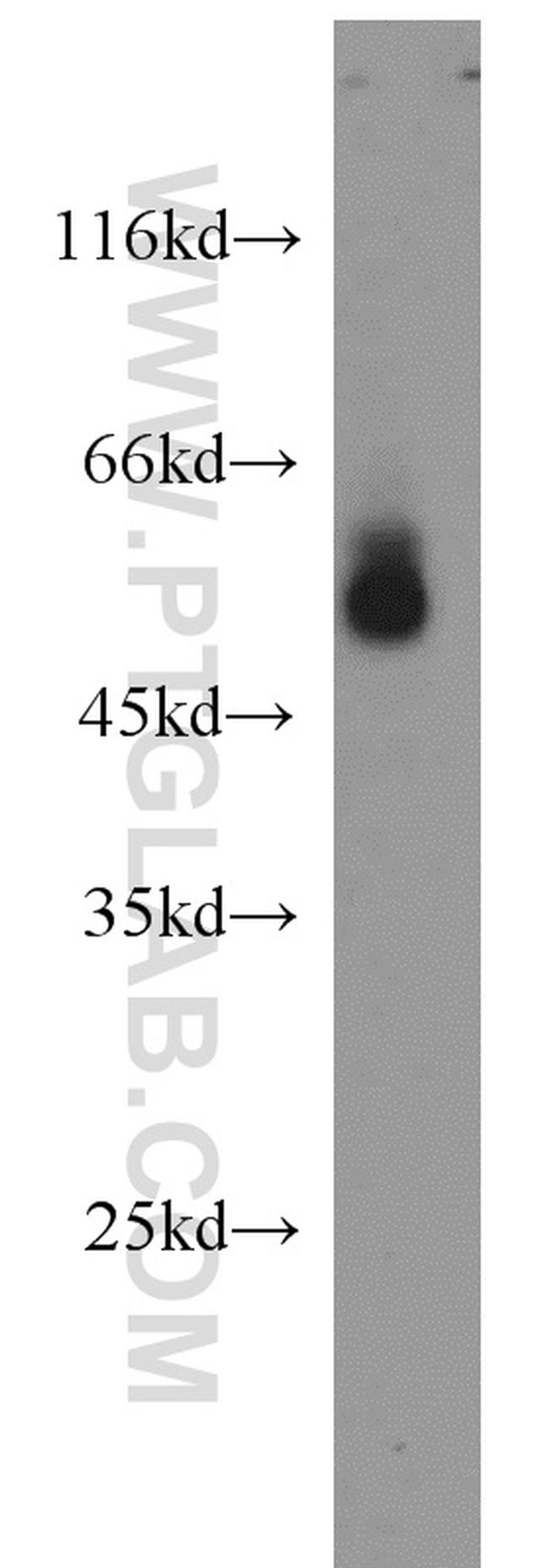 Apolipoprotein H Antibody in Western Blot (WB)