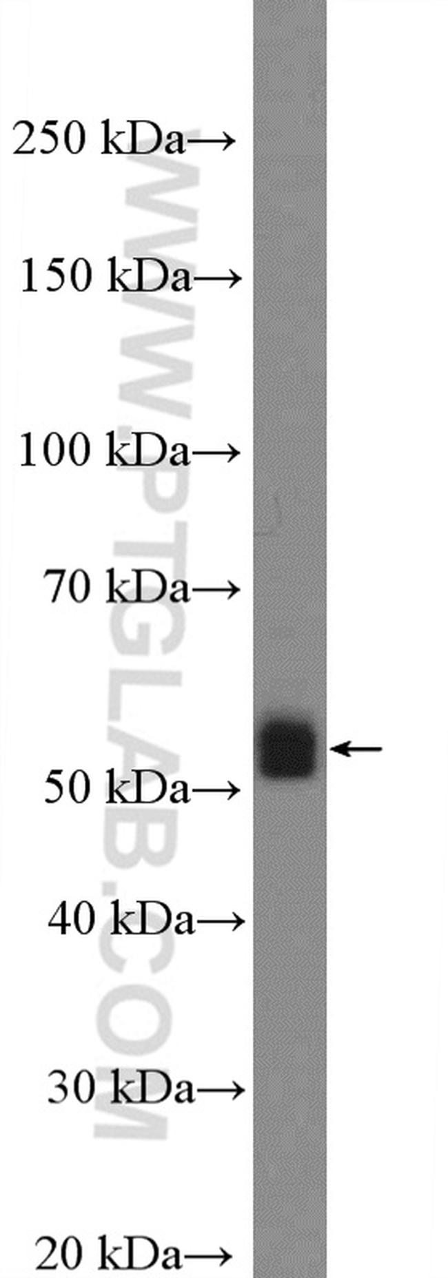 Apolipoprotein H Antibody in Western Blot (WB)