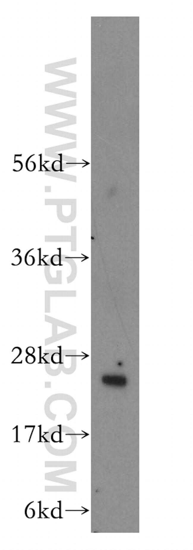 RABL3 Antibody in Western Blot (WB)
