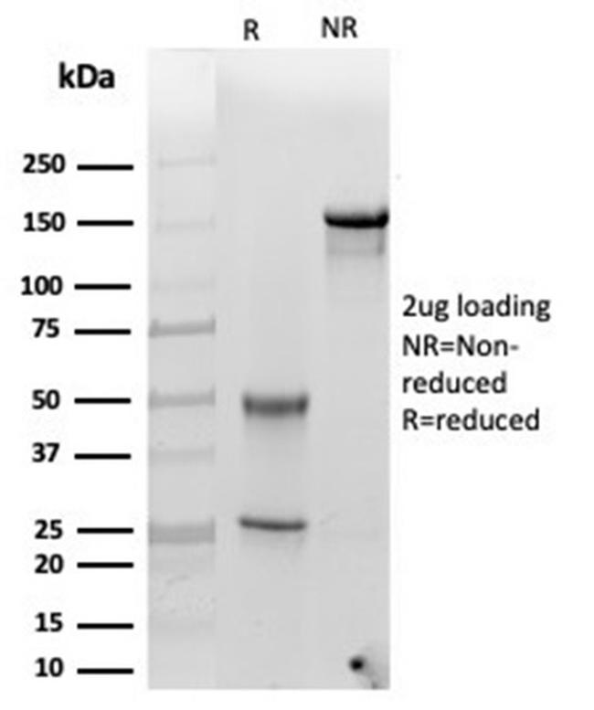 Alpha-1-Antichymotrypsin (SERPINA3) (Histiocytoma Marker) Antibody in Immunoelectrophoresis (IE)