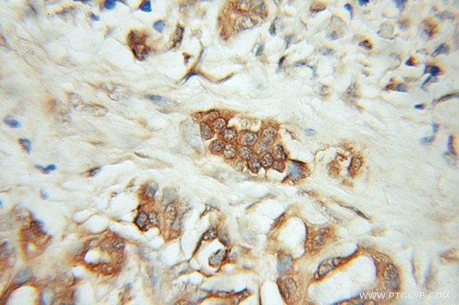 CD164 Antibody in Immunohistochemistry (Paraffin) (IHC (P))