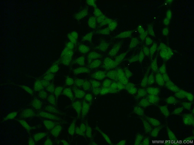 SPIN1 Antibody in Immunocytochemistry (ICC/IF)