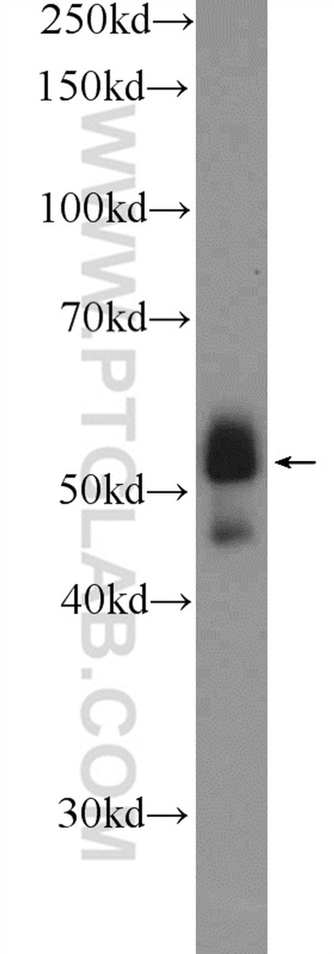 ETS1 Antibody in Western Blot (WB)