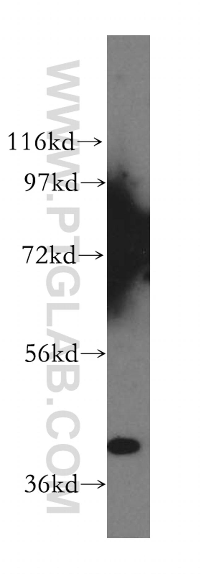 ABHD5 Antibody in Western Blot (WB)