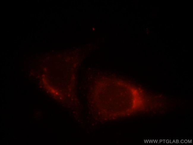 Syntaxin 8 Antibody in Immunocytochemistry (ICC/IF)