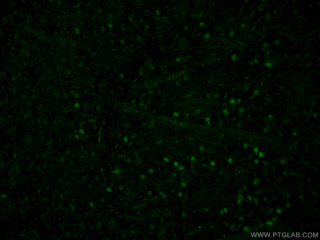 PAX6 Antibody in Immunohistochemistry (PFA fixed) (IHC (PFA))