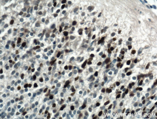 PAX6 Antibody in Immunohistochemistry (Paraffin) (IHC (P))