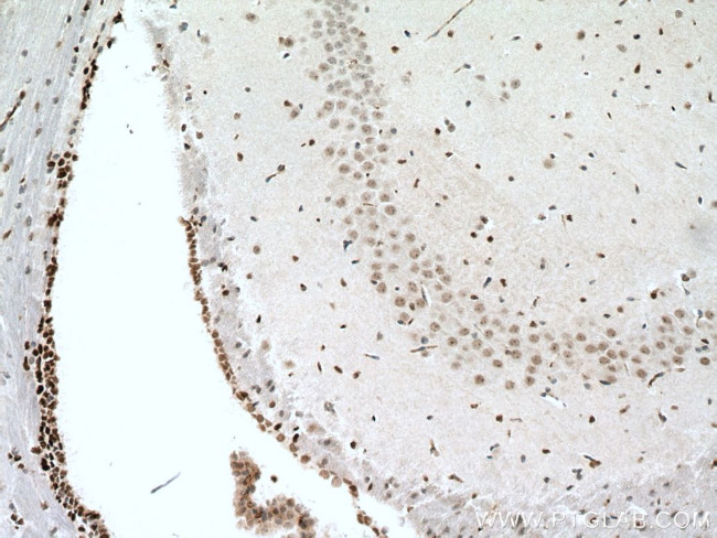 PAX6 Antibody in Immunohistochemistry (Paraffin) (IHC (P))