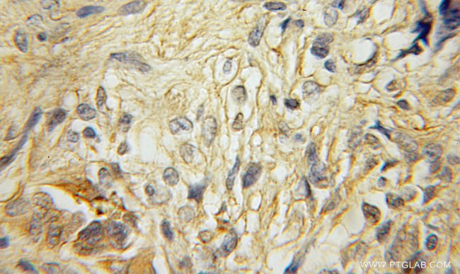 RAB40B Antibody in Immunohistochemistry (Paraffin) (IHC (P))