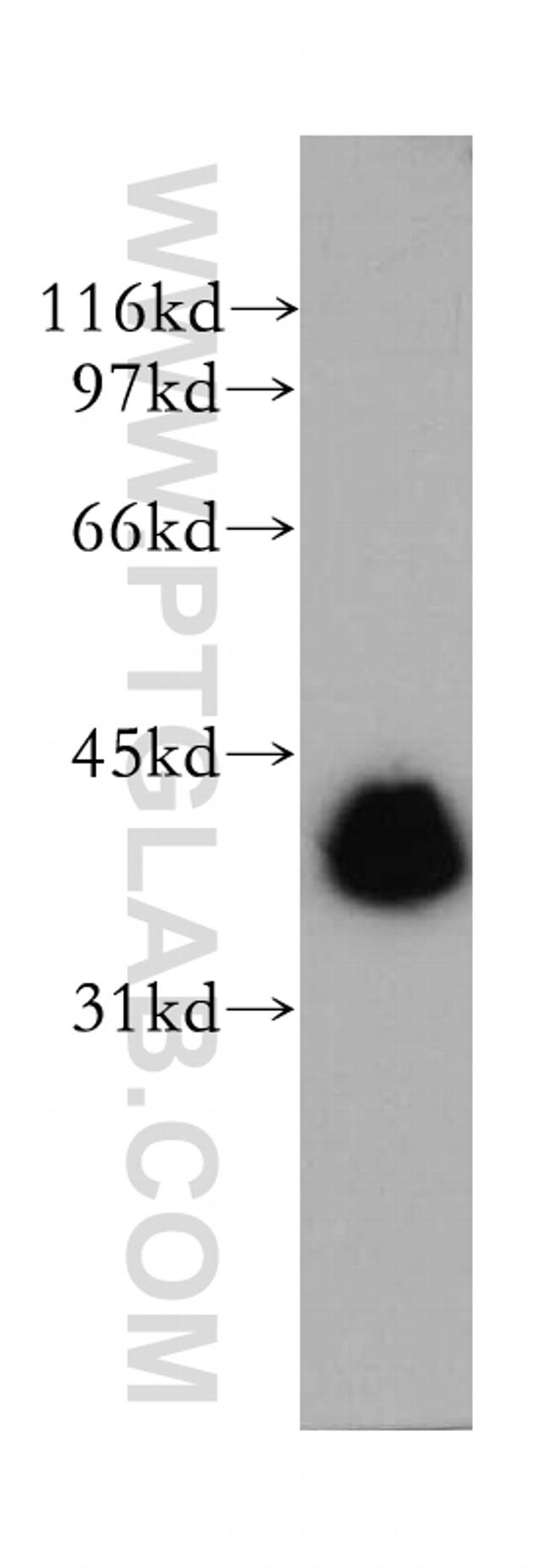 TMOD3 Antibody in Western Blot (WB)
