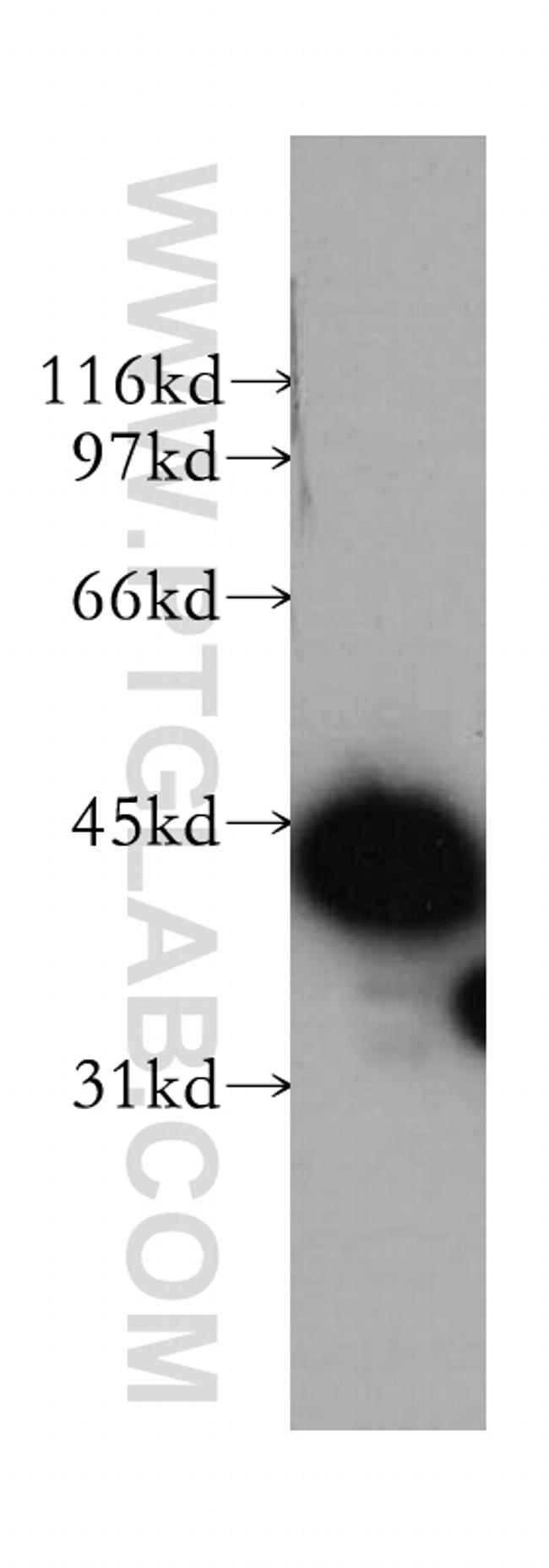TMOD3 Antibody in Western Blot (WB)