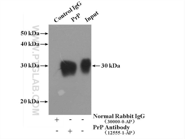 PrP Antibody in Immunoprecipitation (IP)
