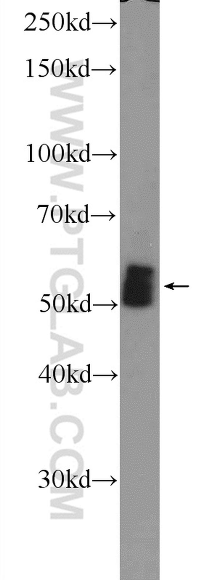 AMPK gamma2 Antibody in Western Blot (WB)