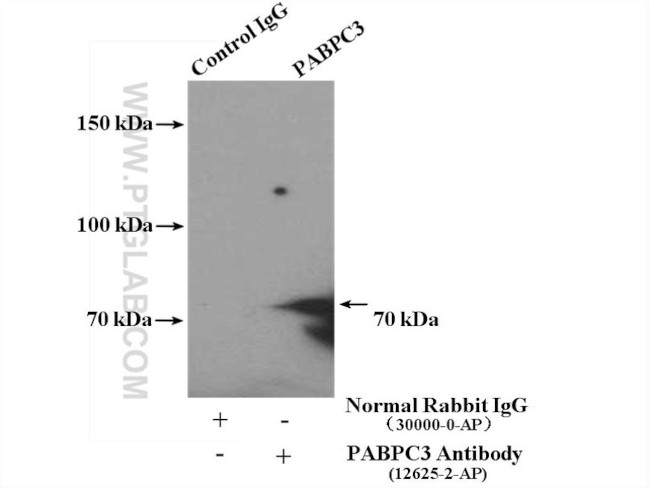 PABPC3 Antibody in Immunoprecipitation (IP)