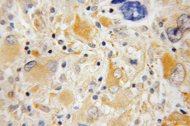 Synaptotagmin-4 Antibody in Immunohistochemistry (Paraffin) (IHC (P))