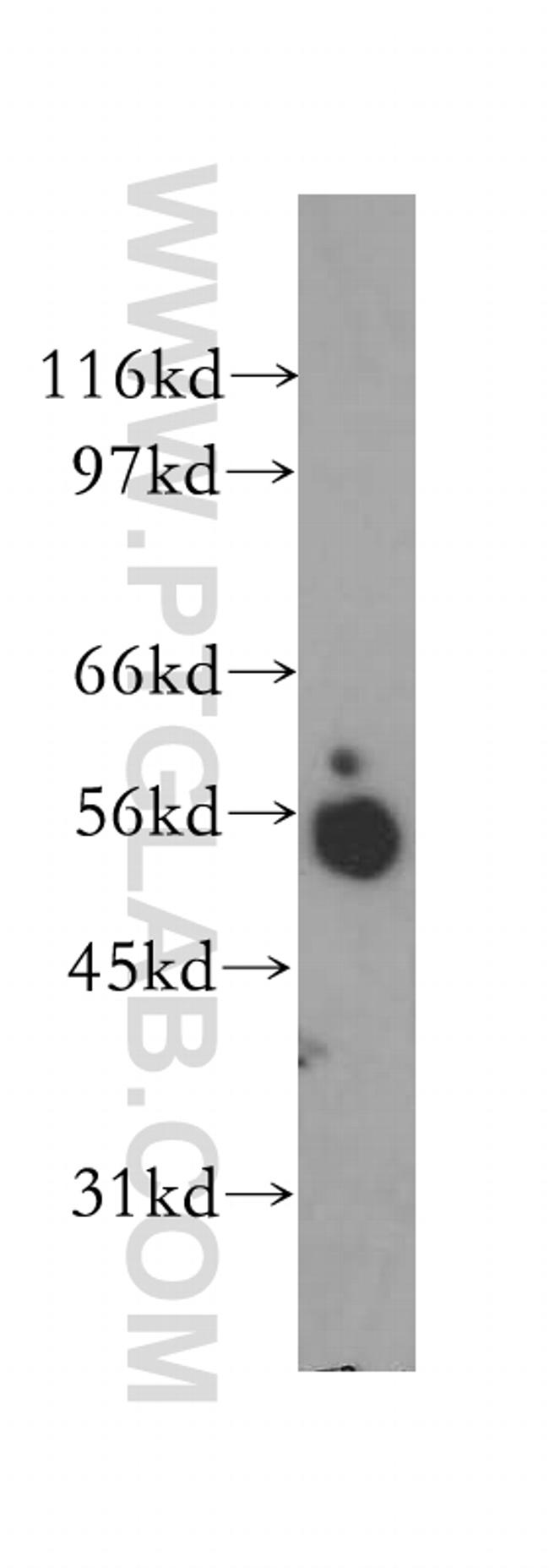 Synaptotagmin-4 Antibody in Western Blot (WB)