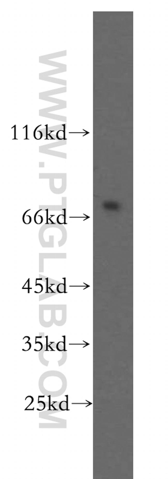 BACE1 Antibody in Western Blot (WB)