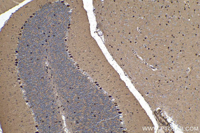 PCDHA6 Antibody in Immunohistochemistry (Paraffin) (IHC (P))