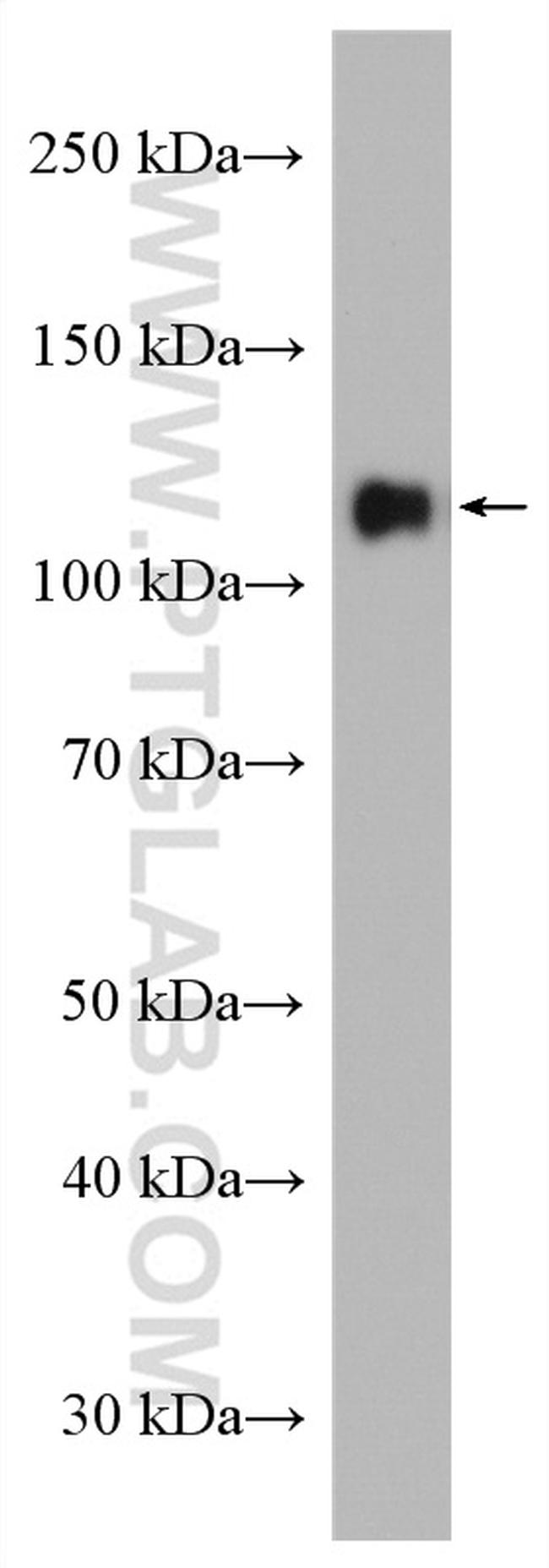 PCDHA6 Antibody in Western Blot (WB)