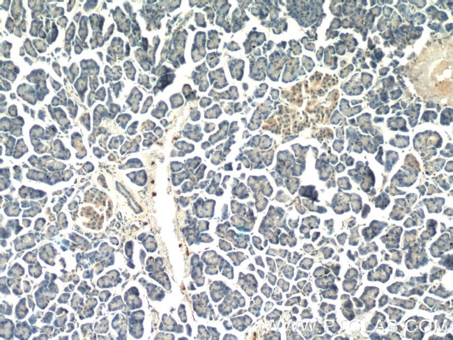 AOAH Antibody in Immunohistochemistry (Paraffin) (IHC (P))