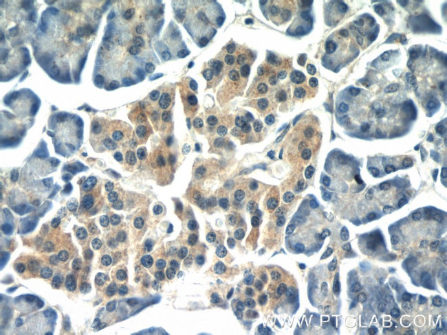 AOAH Antibody in Immunohistochemistry (Paraffin) (IHC (P))