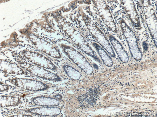 AOAH Antibody in Immunohistochemistry (Paraffin) (IHC (P))