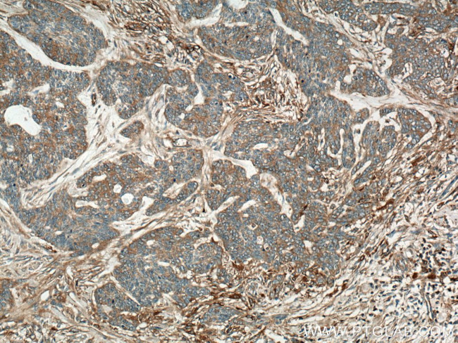 SLC27A3 Antibody in Immunohistochemistry (Paraffin) (IHC (P))