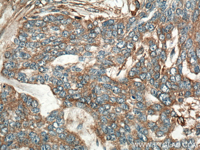 SLC27A3 Antibody in Immunohistochemistry (Paraffin) (IHC (P))