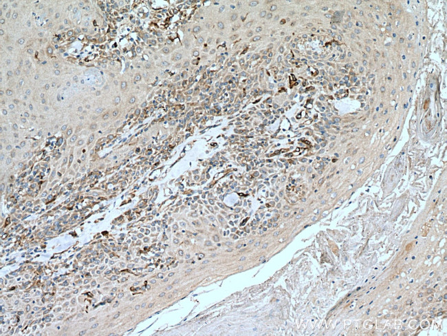 SLC27A3 Antibody in Immunohistochemistry (Paraffin) (IHC (P))