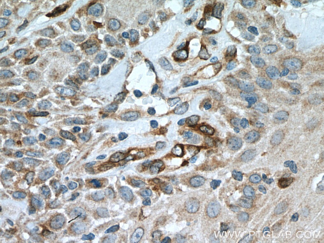 SLC27A3 Antibody in Immunohistochemistry (Paraffin) (IHC (P))