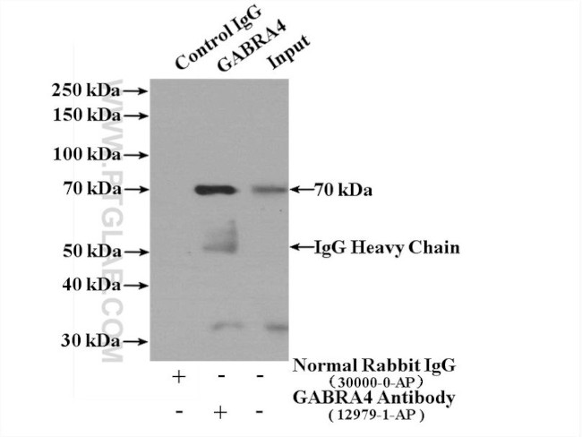 GABRA4 Antibody in Immunoprecipitation (IP)