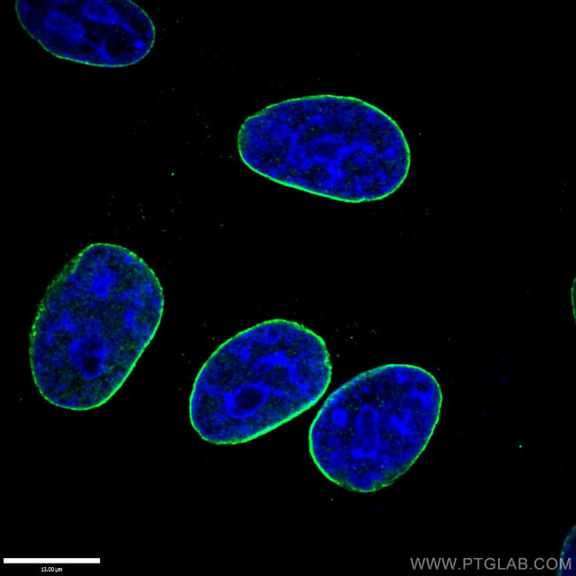 Lamin B1 Antibody in Immunocytochemistry (ICC/IF)