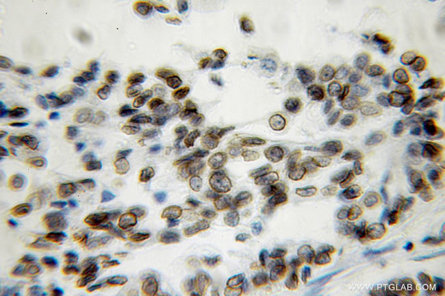 Lamin B1 Antibody in Immunohistochemistry (Paraffin) (IHC (P))