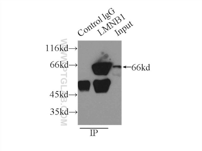 Lamin B1 Antibody in Immunoprecipitation (IP)