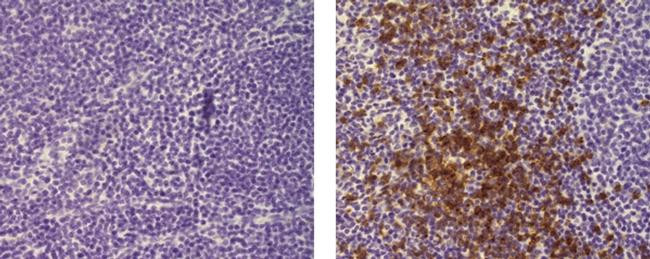 Mouse IgG2a kappa Isotype Control in Immunohistochemistry (Paraffin) (IHC (P))