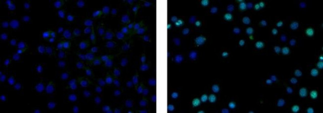 Ki-67 Antibody in Immunocytochemistry (ICC/IF)