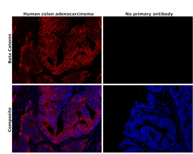 beta Catenin Antibody in Immunohistochemistry (Paraffin) (IHC (P))