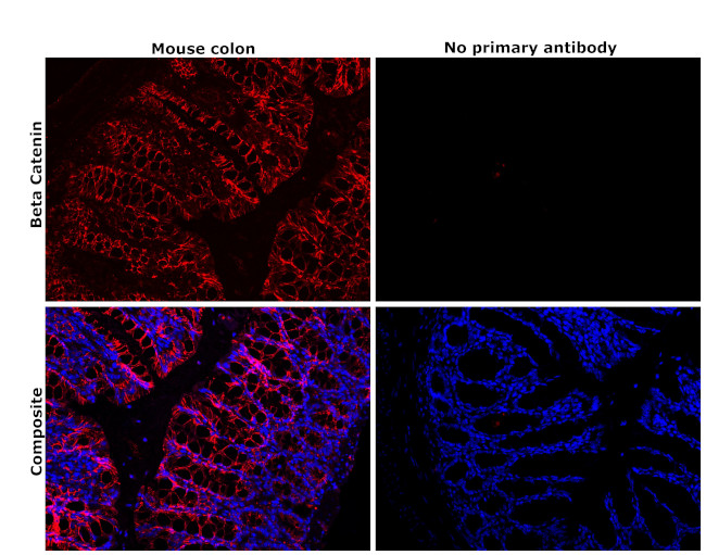 beta Catenin Antibody in Immunohistochemistry (Paraffin) (IHC (P))