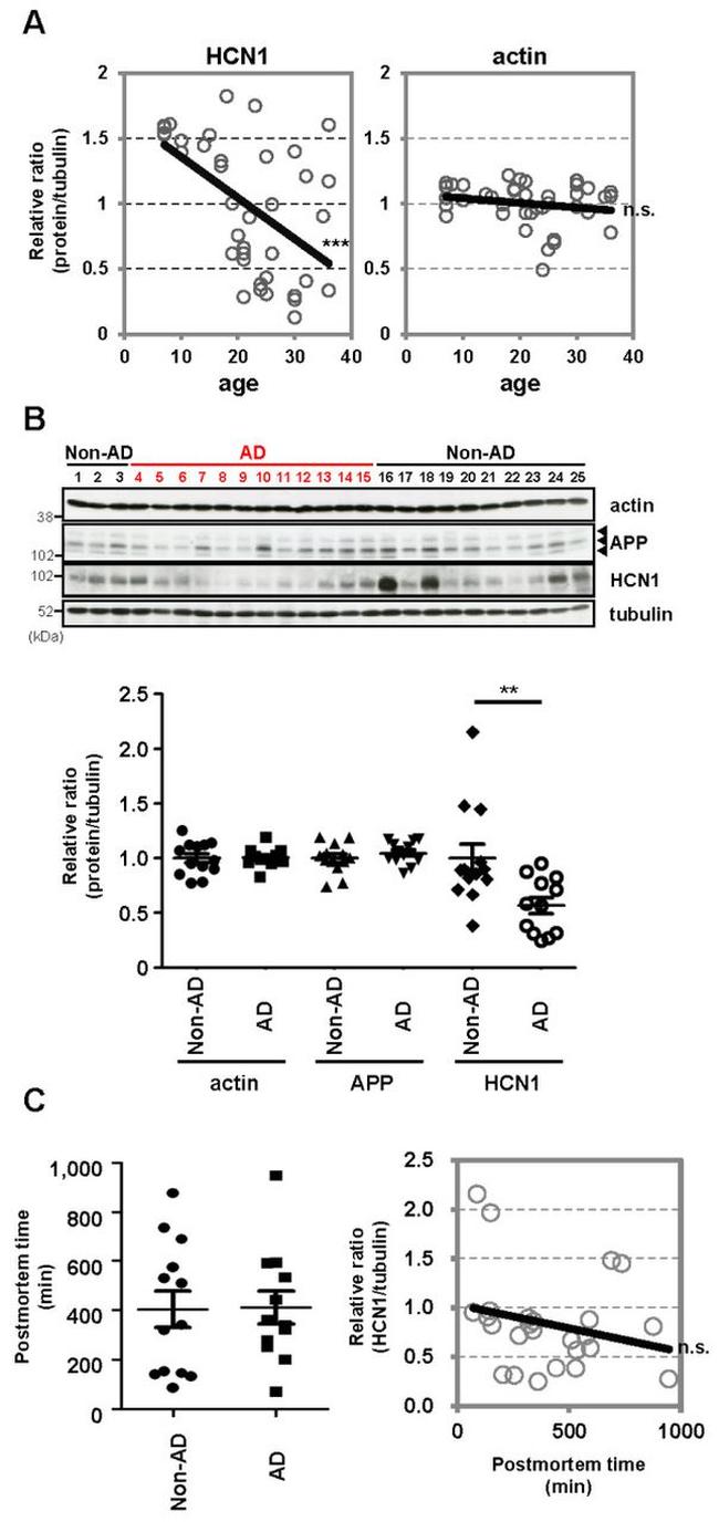 Amyloid Precursor Protein Antibody in Western Blot (WB)