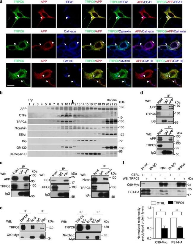 Amyloid Precursor Protein Antibody in Western Blot, Immunocytochemistry, Immunoprecipitation (WB, ICC/IF, IP)