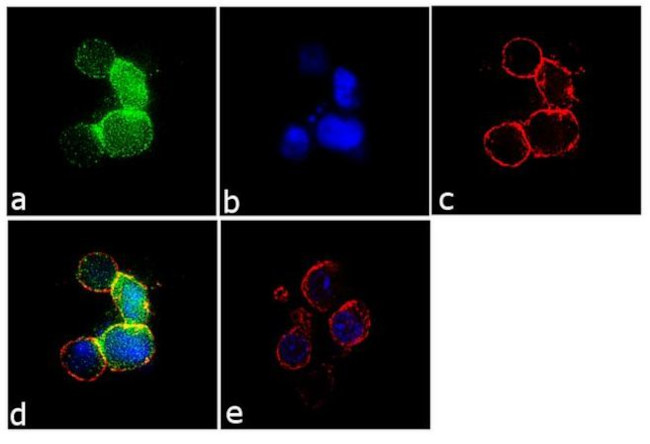 Zap-70 Antibody in Immunocytochemistry (ICC/IF)