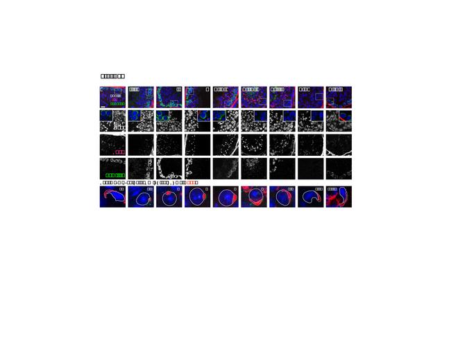 Sp56 Antibody in Immunohistochemistry (IHC)