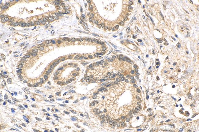 FOXM1 Antibody in Immunohistochemistry (Paraffin) (IHC (P))