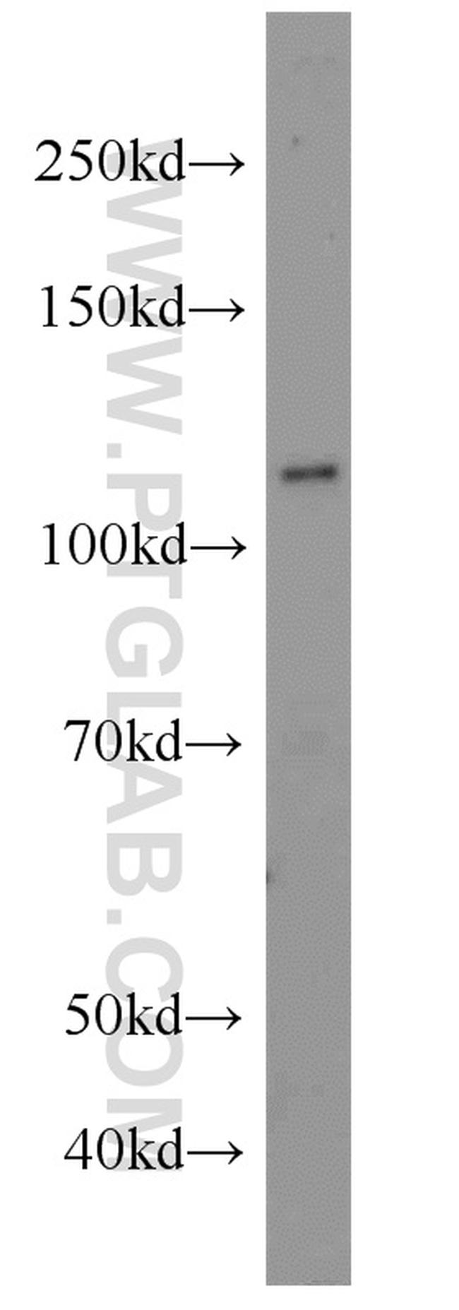 FOXM1 Antibody in Western Blot (WB)