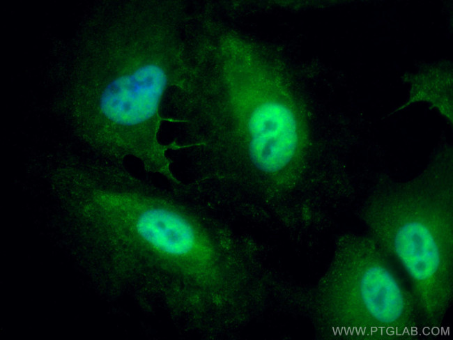 UGDH Antibody in Immunocytochemistry (ICC/IF)