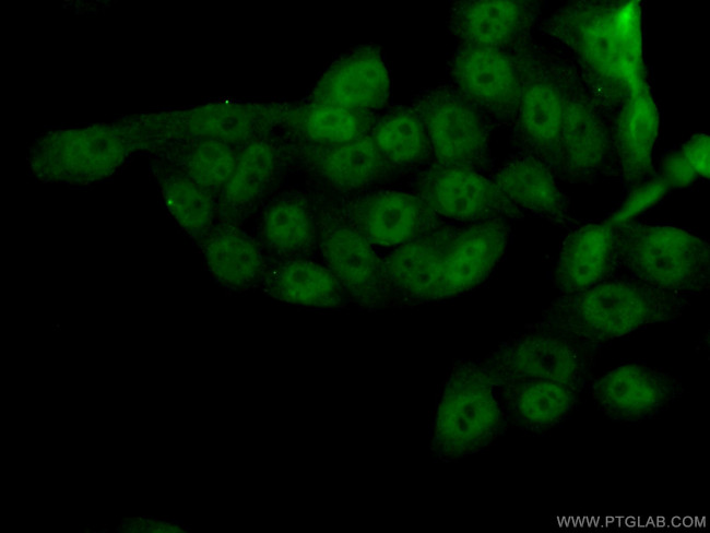 SIRT1 Antibody in Immunocytochemistry (ICC/IF)