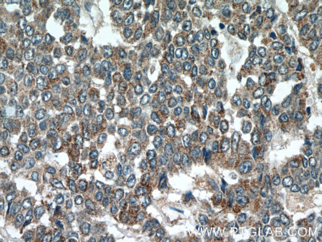 SIRT1 Antibody in Immunohistochemistry (Paraffin) (IHC (P))