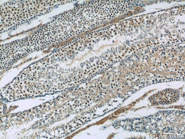 SIRT1 Antibody in Immunohistochemistry (Paraffin) (IHC (P))