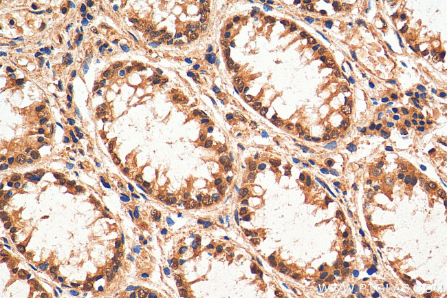 SIRT1 Antibody in Immunohistochemistry (Paraffin) (IHC (P))