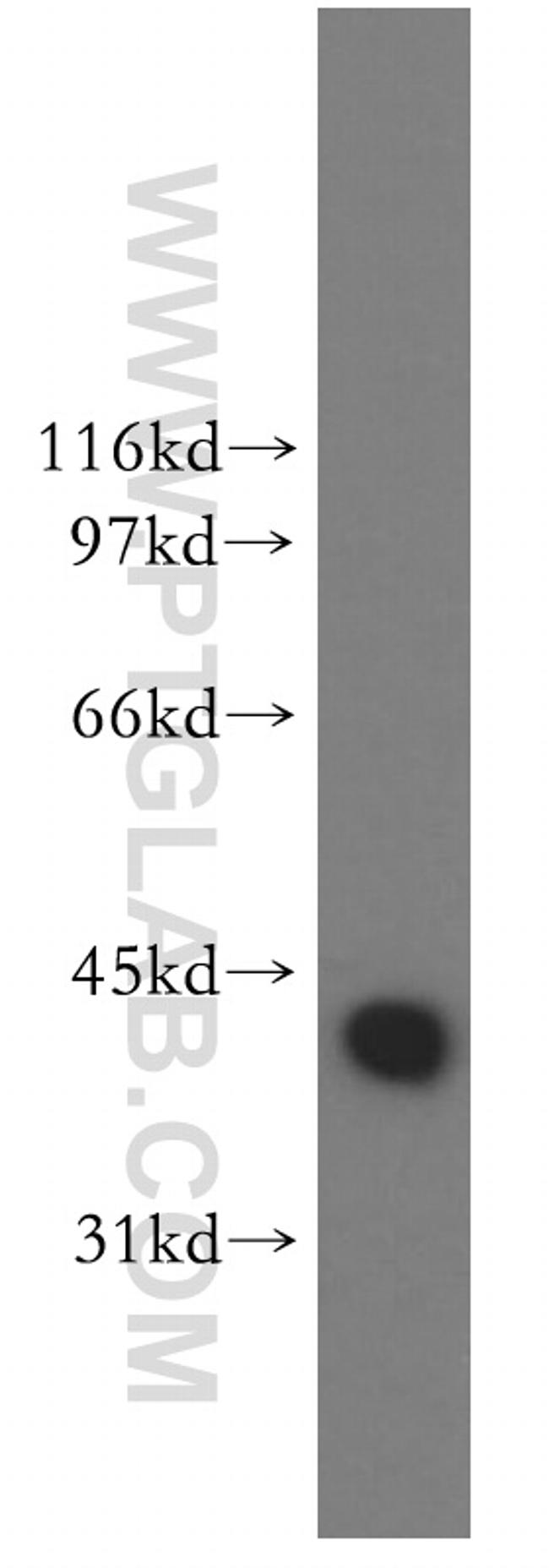 DNAJB1 Antibody in Western Blot (WB)